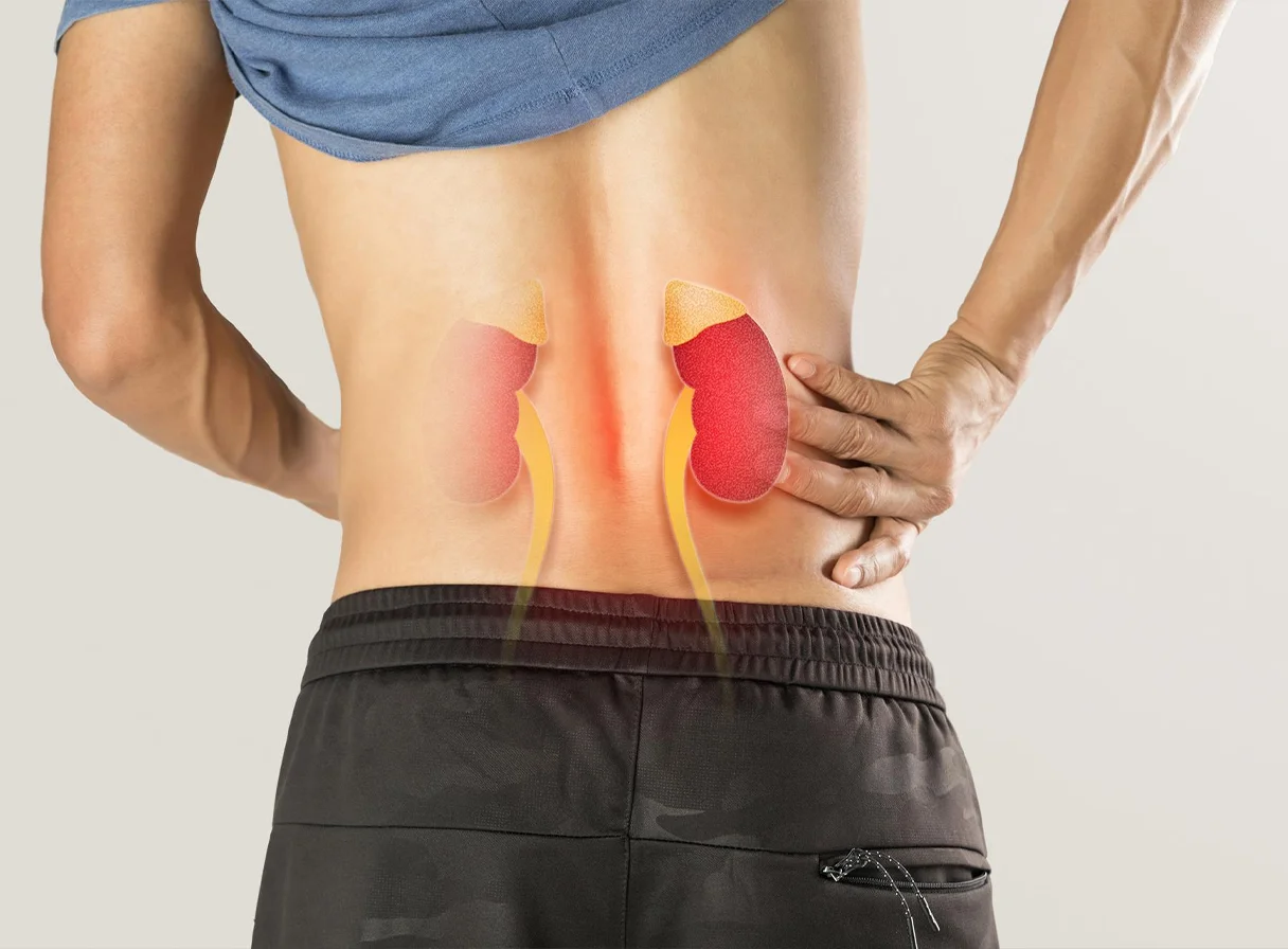 Chronic Kidney Disease: Causes, Symptoms, and Management